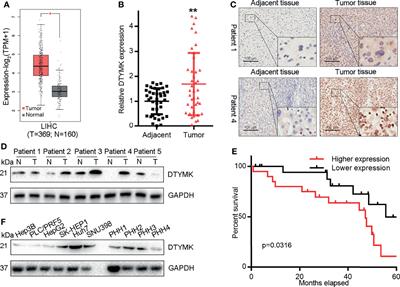 MiR-148b-3p Regulates the Expression of DTYMK to Drive Hepatocellular Carcinoma Cell Proliferation and Metastasis